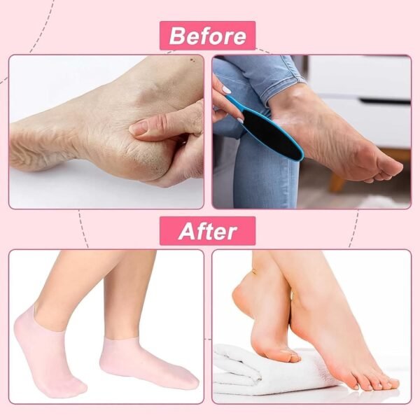 03_65e926f8-6717-4381-9280-ad33af0fb06e.jpg Silicone Moisturizing Socks (1 Pair)