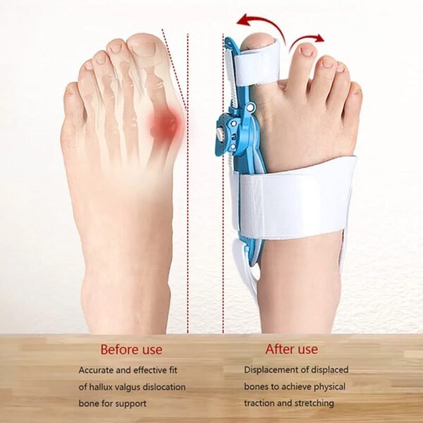 03_6dcb13a5-3c31-4eb3-a1ca-6f4531c8f1d8.jpg Adjustable Bunion Support Splint – Hallux Valgus Corrector for Men & Women