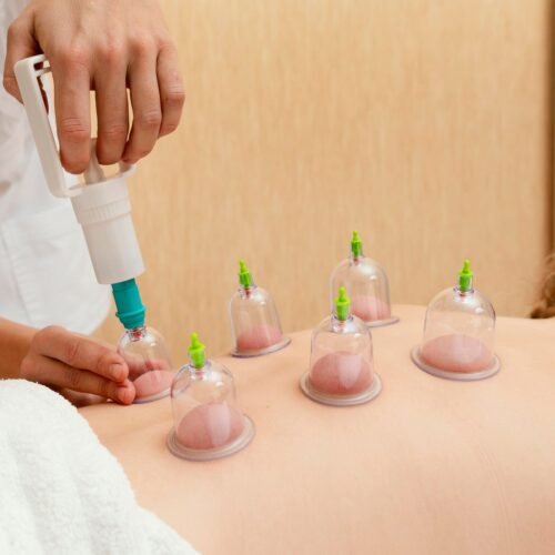 03_aa87687a-aeff-4da6-8743-99b2cf99c02a.jpg Vacuum Cupping Set – 6 Pc Massage Therapy Suction Kit for Relaxation