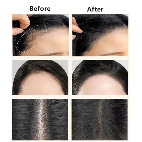 Hairline & Eyebrow Shaping - (Set)