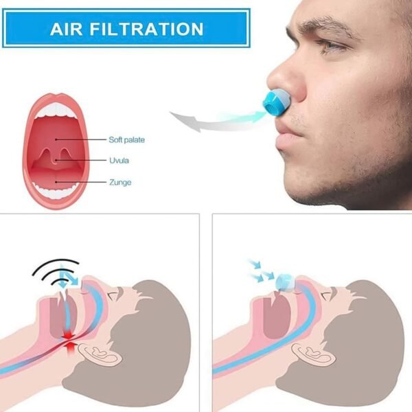 2 in 1 Anti-Snoring & Air Purifier Nose Clip Device (1 Pc / With Plastic Case)