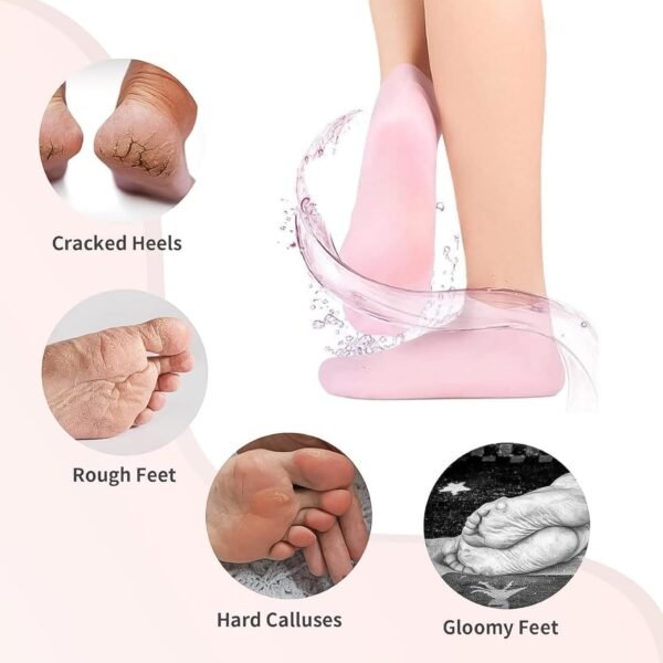 05_c6e9485c-c963-42cb-bebc-8b2507520c80.jpg Silicone Moisturizing Socks (1 Pair)