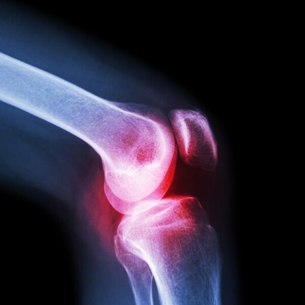 06_58e503de-147c-46cb-bb20-9251de7f9edb.jpg Knee Cap for Knee Support (Large)