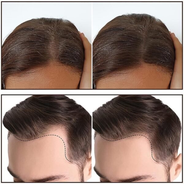 Hairline & Eyebrow Shaping - (Set)