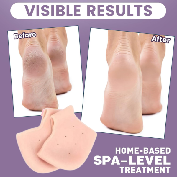 Anti Crack Silicone Half Gel Heel And Foot Protector Moisturizing Socks
