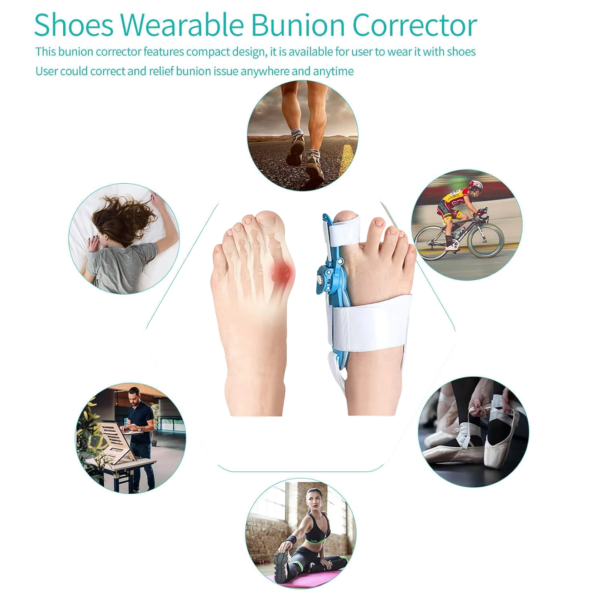 20084.png Adjustable Bunion Support Splint – Hallux Valgus Corrector for Men & Women