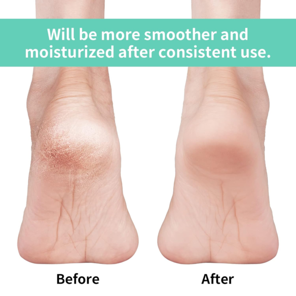 20365_ac24b1a0-4678-4b44-8a71-c7bee0ac9450.png Anti Crack Silicon Gel Heel Moisturizing Socks for Foot Care Men Women (Loose Pack)