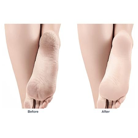 Nano Glass Foot Scraper – Dead Skin Exfoliating Foot Grinding Tool