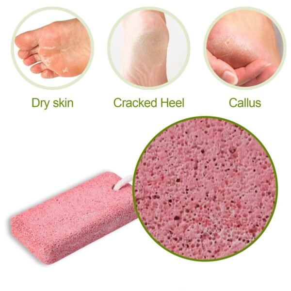 PumiceStone-02.jpg Rectangular Foot Pumice Stone for Dead Skin & Callus Removal (1 Pc)