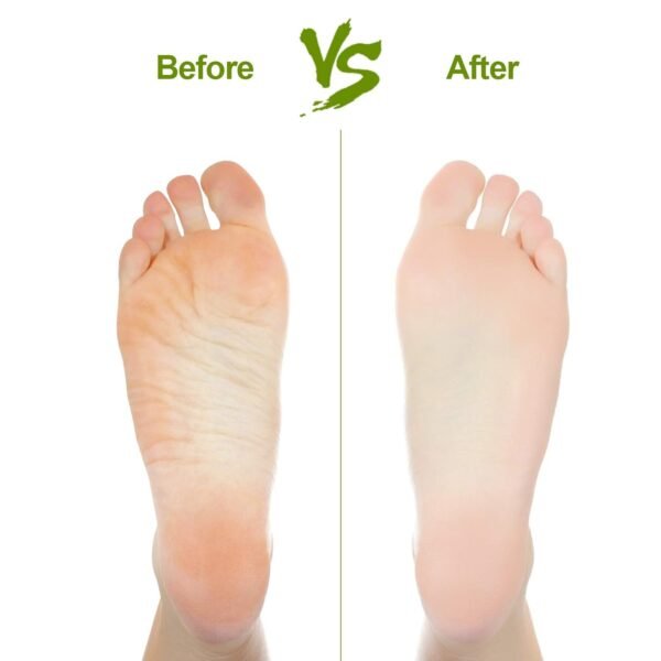 PumiceStone-03.jpg Rectangular Foot Pumice Stone for Dead Skin & Callus Removal (1 Pc)