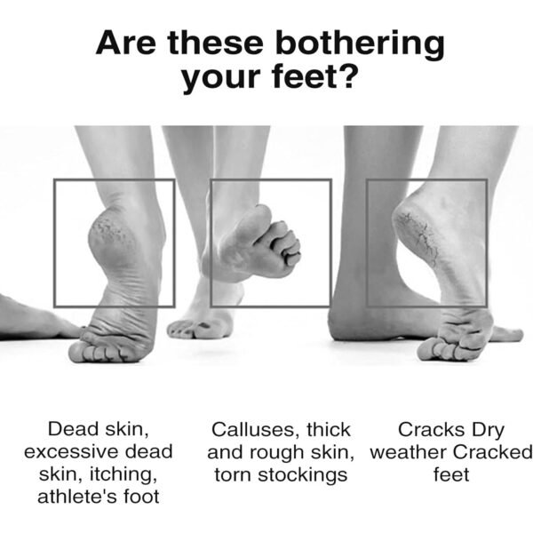 PumiceStone-06.jpg Rectangular Foot Pumice Stone for Dead Skin & Callus Removal (1 Pc)