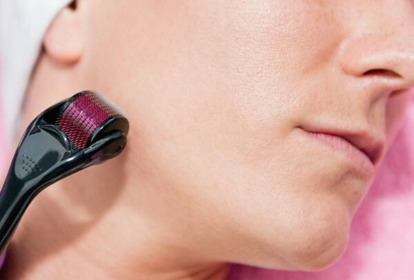 Derma Roller Anti Ageing and Facial Scrubs & Polishes Scar Removal Hair Regrowth